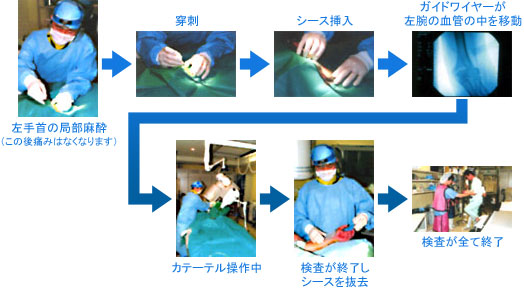 冠動脈造影検査の流れ
